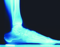 Injury 3-12