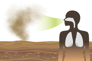 Valley Fever