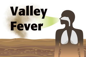 Valley fever graphic