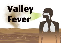 Valley fever graphic