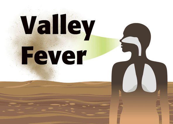 Valley fever graphic