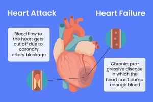 Heart attack graphic