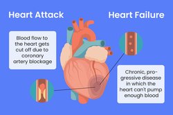 Heart attack graphic